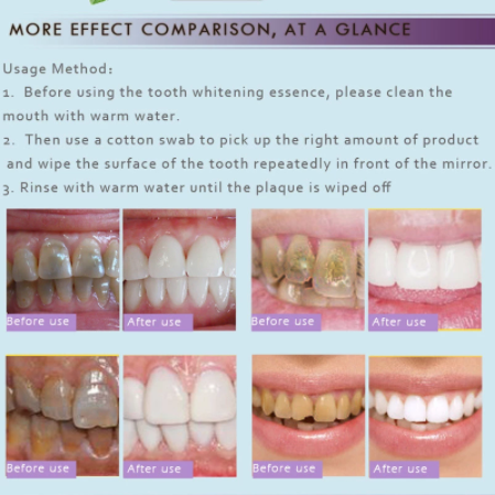 RtopR Teeth Whitening Serum Oral Hygiene Cleansing Essence Removes Plaque Stains Yellow Tooth Bleaching Dental Care Tools 10