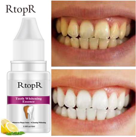 RtopR Teeth Whitening Serum Oral Hygiene Cleansing Essence Removes Plaque Stains Yellow Tooth Bleaching Dental Care Tools 10ml