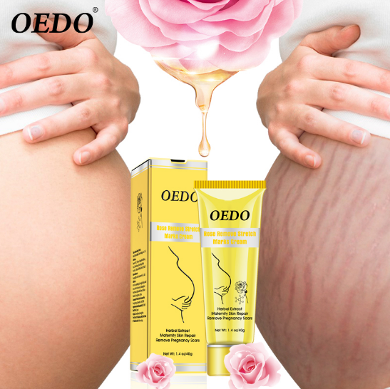 Rose Remove Stretch Marks Cream Anti Wrinkle Anti Aging Maternity Skin Repair Remove Pregnancy Scars Treatment Body Skin Care