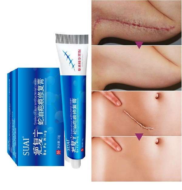 SUAT Acne Scar Stretch Marks Remover Cream Skin Repair Face Cream Acne Spots Acne Treatment Blackhead Whitening Cream Skin Care